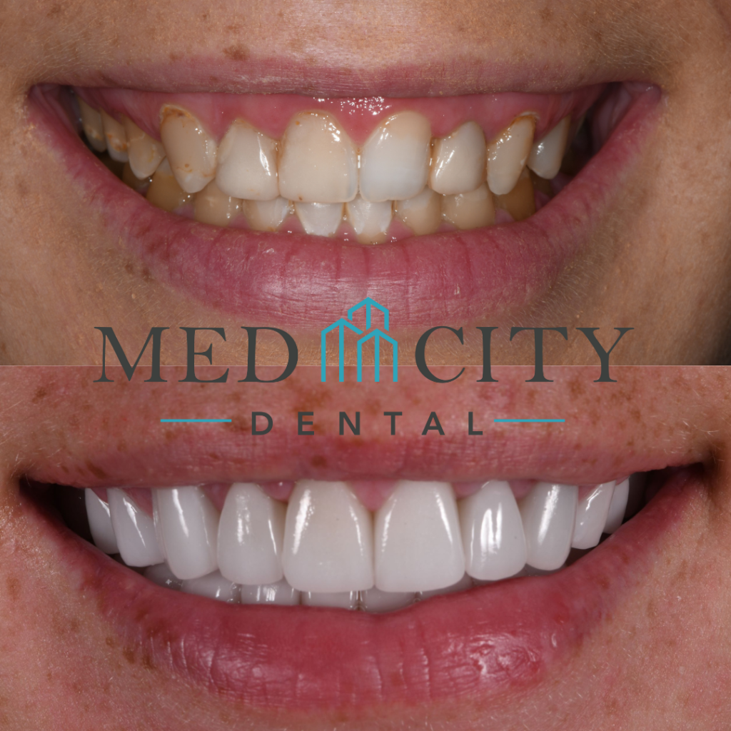 Before & After Cosmetic Treatments Case #1