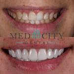 Before & After Cosmetic Treatments Case #1
