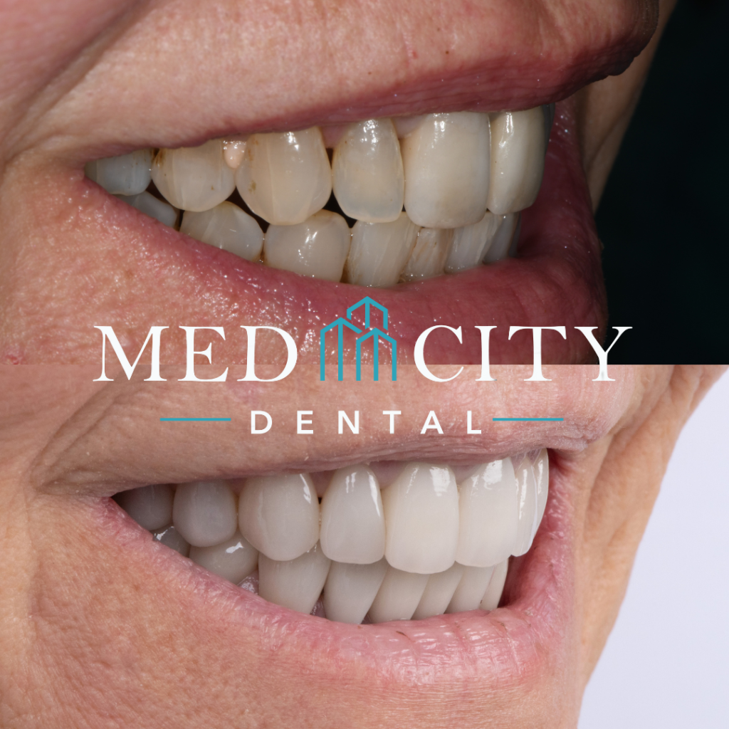 Cosmetic Treatments - Before & After