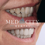 Cosmetic Treatments - Before & After